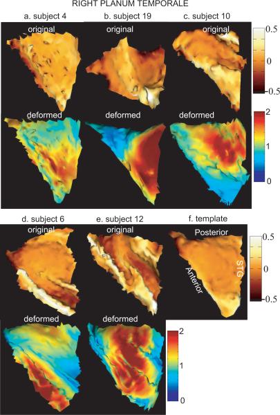 FIG. 4