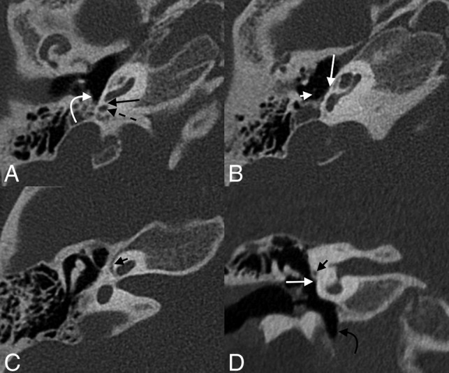 FIG 3.