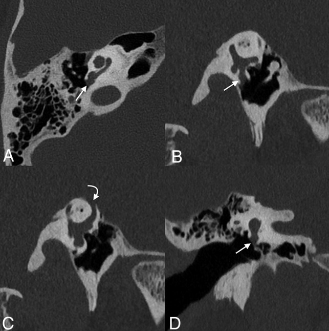 FIG 12.