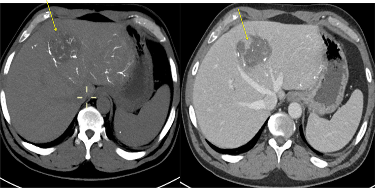 Fig. 12