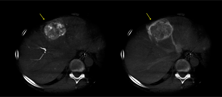 Fig. 8