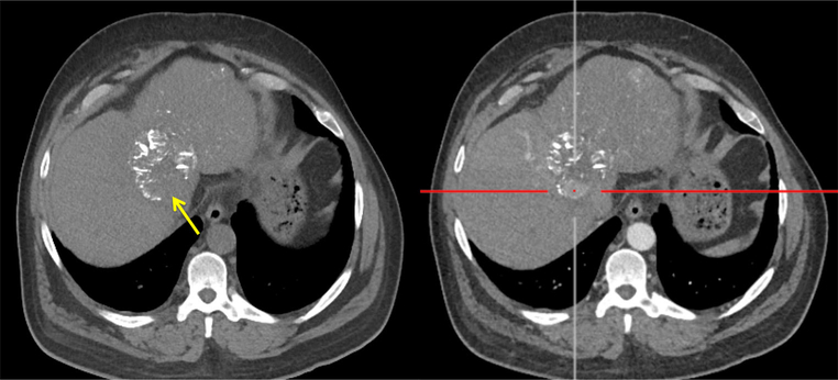 Fig. 16