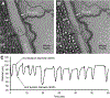 Fig. 11.