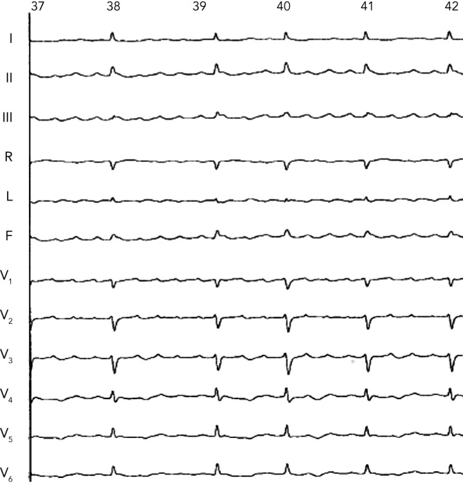 Figure 4: