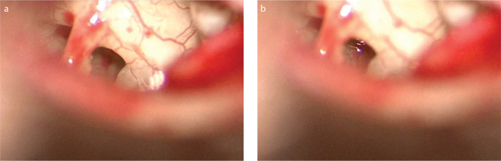 Figure 1. a, b