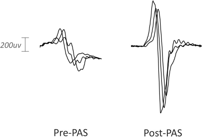 FIGURE 3