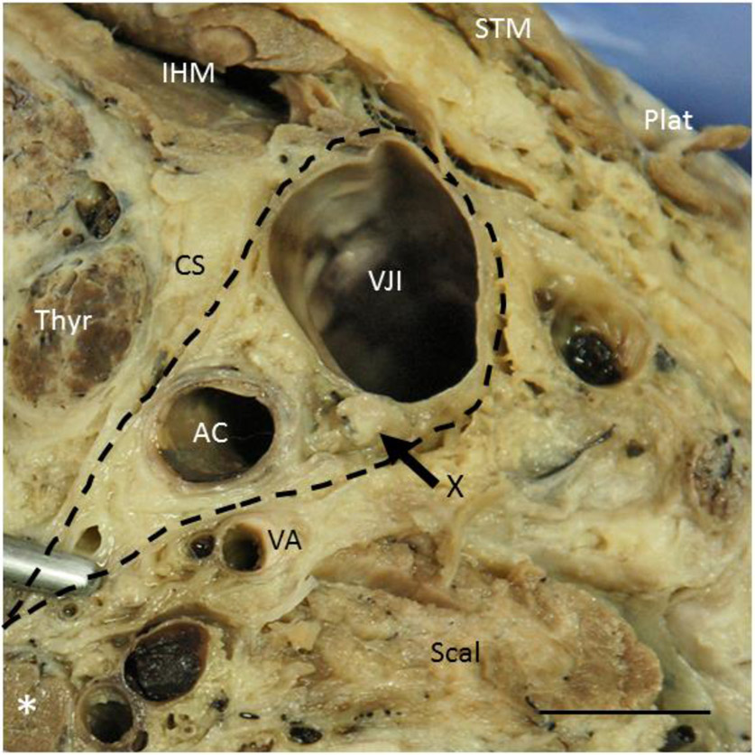 Fig. 1: