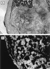FIG. 17
