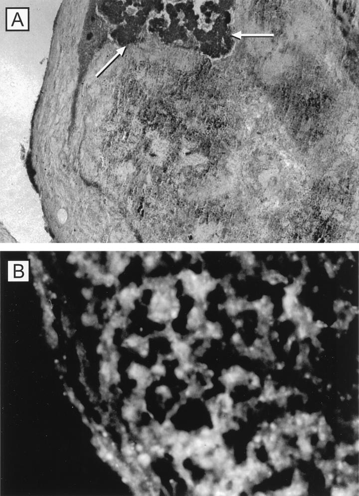 FIG. 17