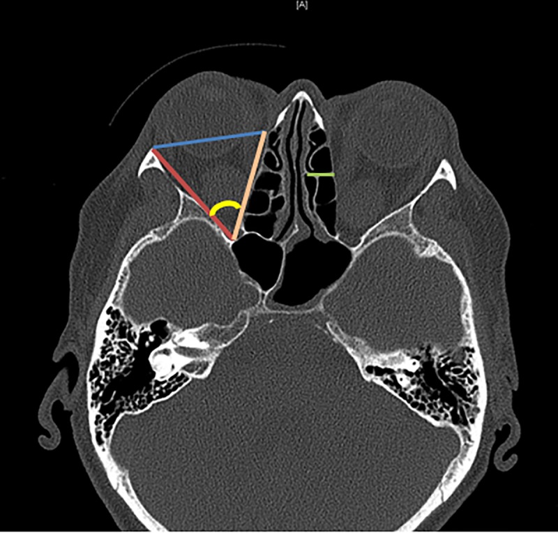 Fig 2