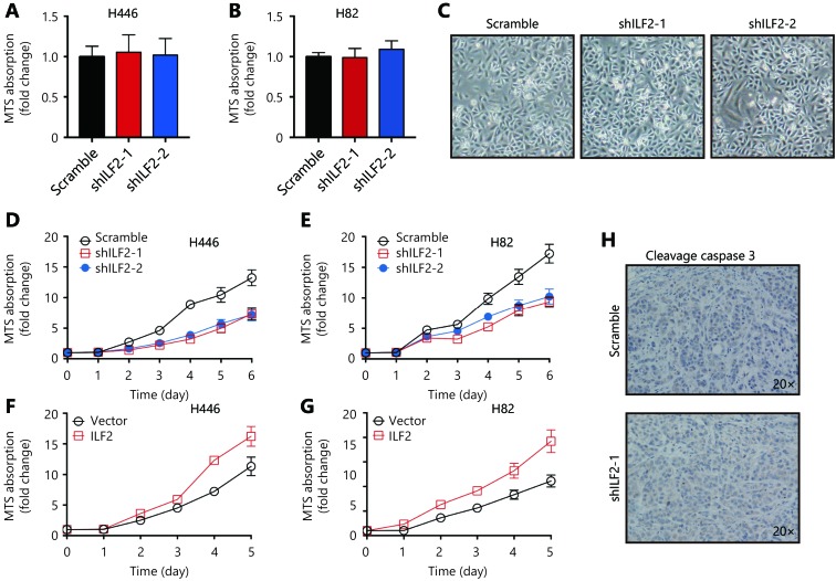 (A and B) Cell viability of H446 and H82 cells infected with shILF2-1, shILF2-2 or scramble-shRNA were determined by MTS assay. (C) Morphology of H446 and H82 cells infected with shILF2-1, shILF2-2 or scramble-shRNA. (D and E) Proliferation curve of H446 and H82 cells infected with shILF2-1, shILF2-2 or scramble-shRNA determined by MTS assay. (F and G) Proliferation curve of H446 and H82 cells infected with ILF2 expressing or vector lentivirus. (H) Xenograft tumor sections were stained with anti-cleavage caspase 3 antibody. *, <italic>P</italic> < 0.05, **, <italic>P</italic> < 0.01.