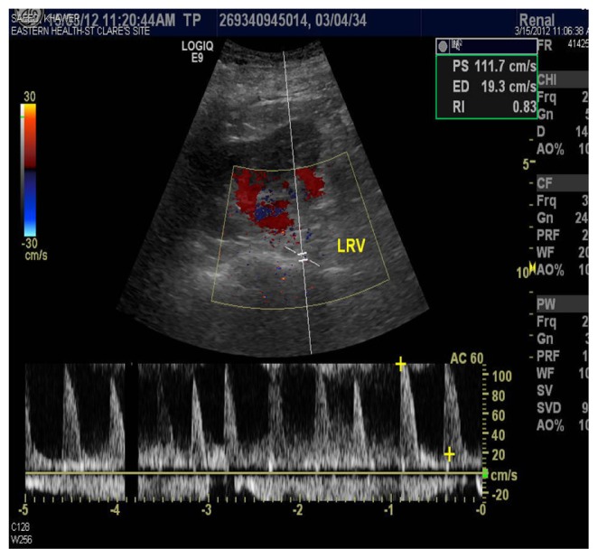 Figure 4