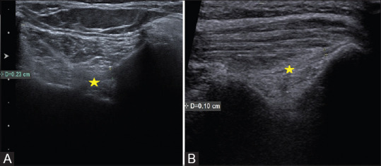 Figure 3(A and B)