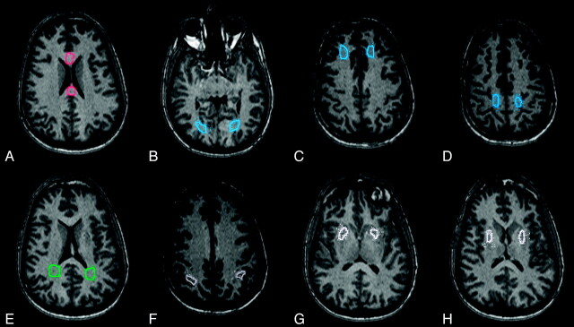 Fig 1.