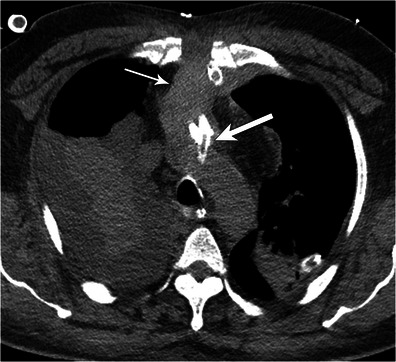 Fig. 11