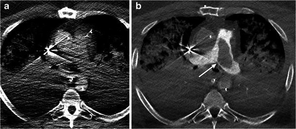 Fig. 12