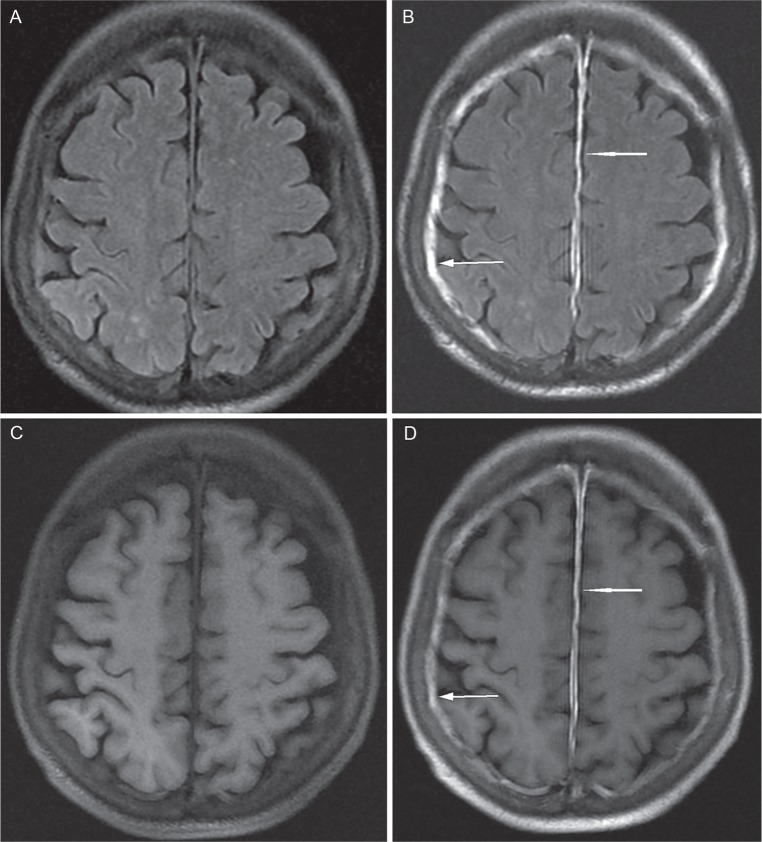 Fig 3.