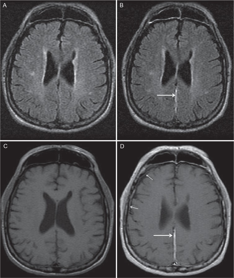 Fig 2.