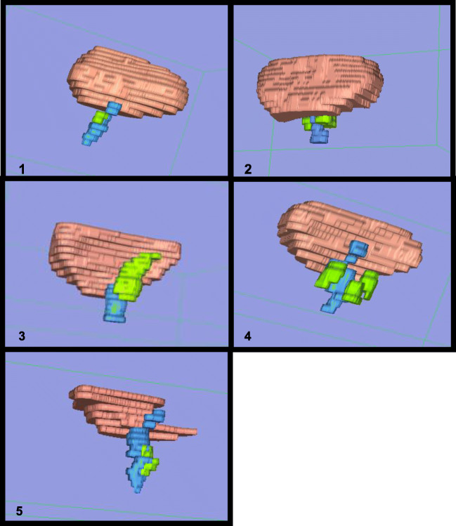 Fig. 1