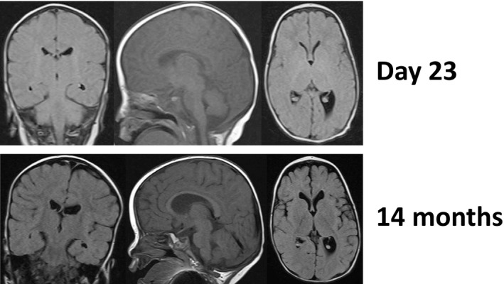 FIGURE 2