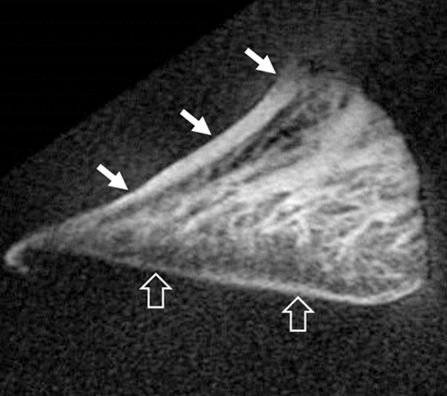 Figure 3b: