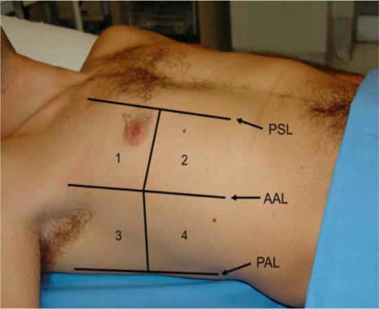 Fig. 1