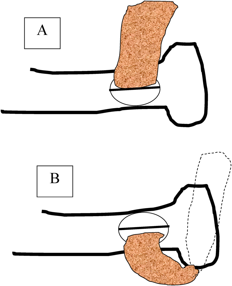 Fig. 5