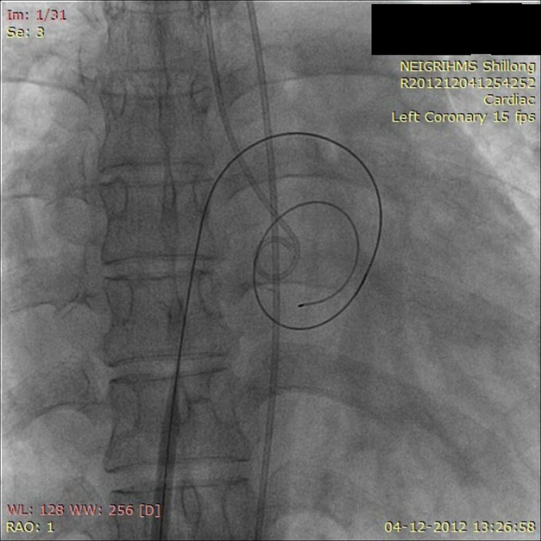 Figure 1