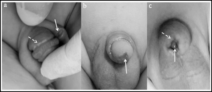 Fig.3