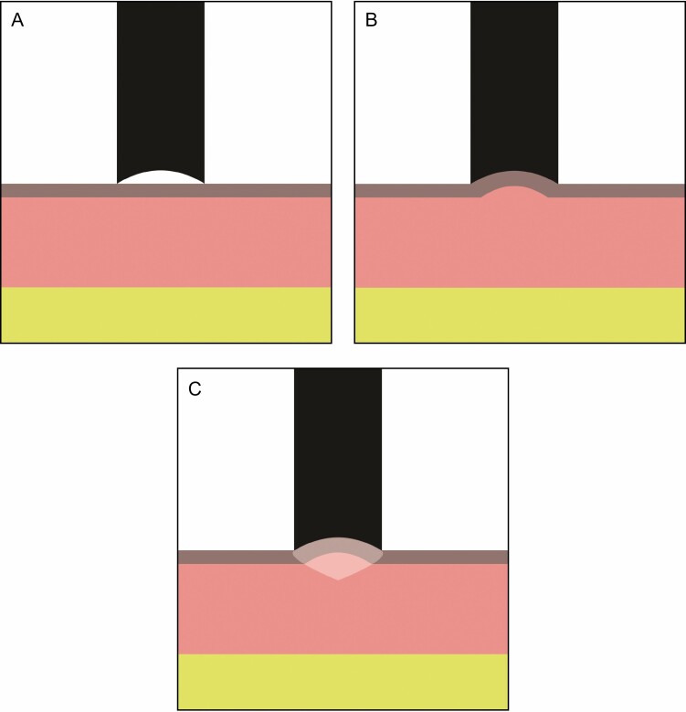 Figure 10.