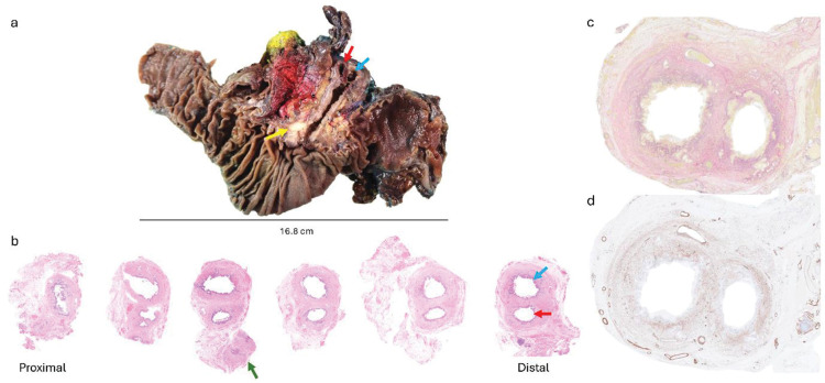 Fig. 2