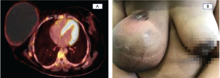 Figure 3