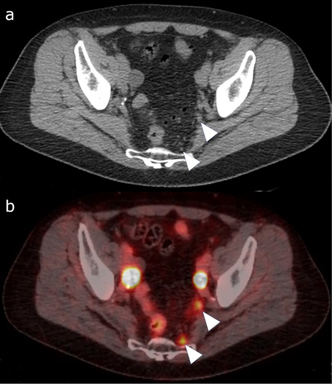 Figure 2: