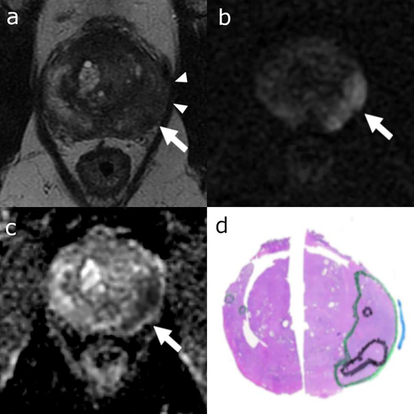 Figure 1: