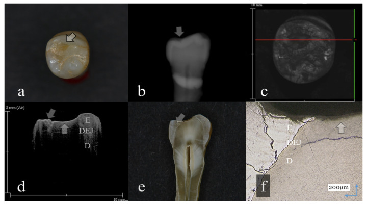 Figure 6