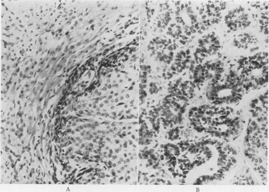 Fig. 14 (A) (Case 9).