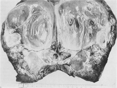 Fig. 9 (Case 7).