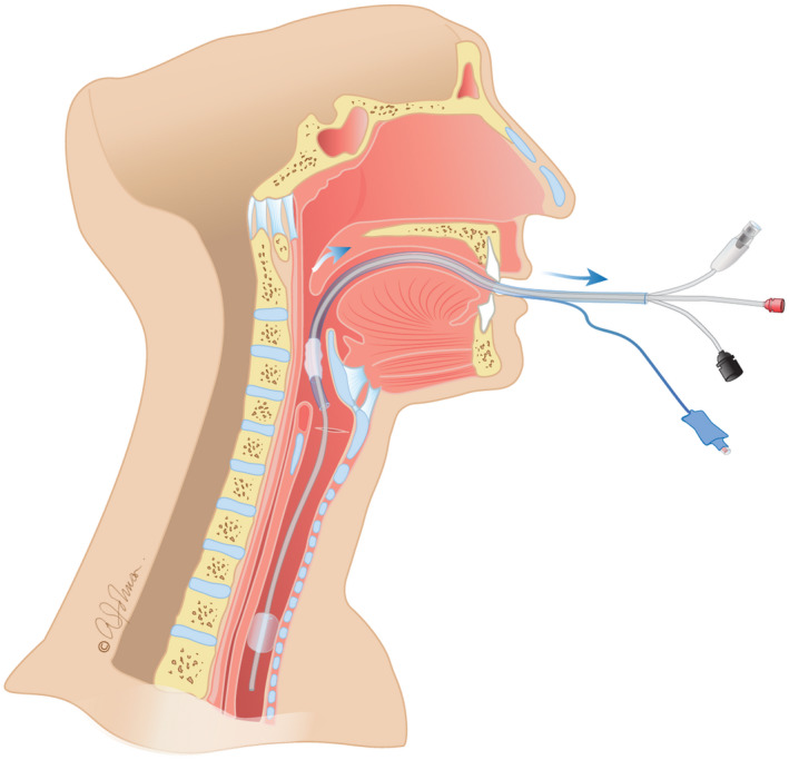 FIGURE 2