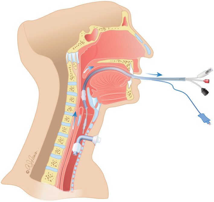 FIGURE 4