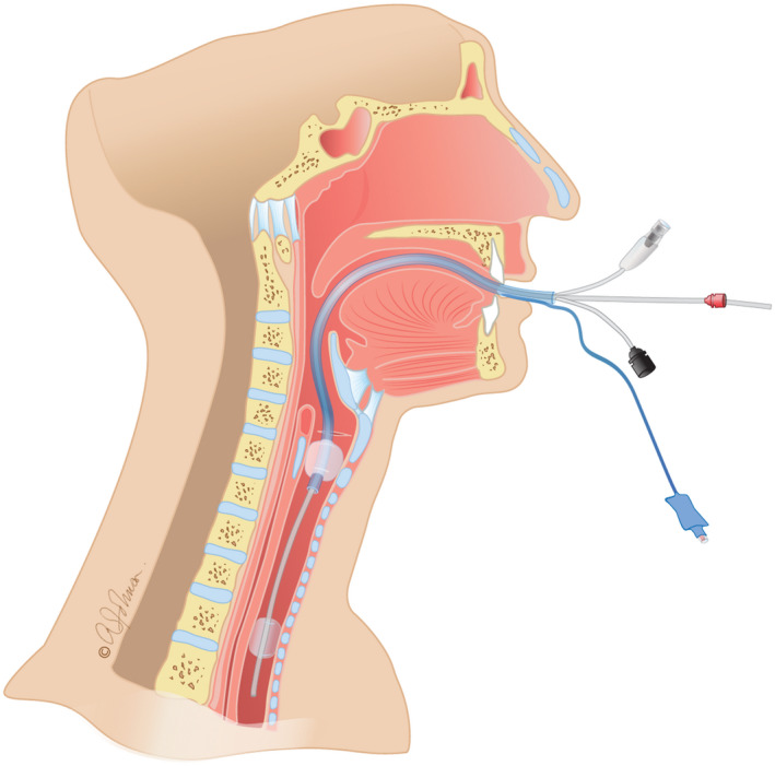 FIGURE 1