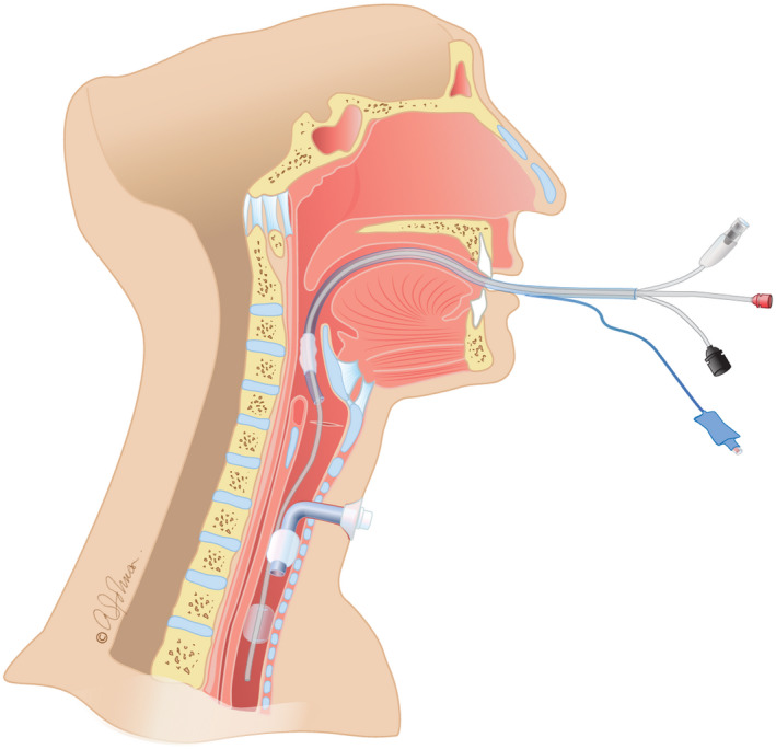 FIGURE 3