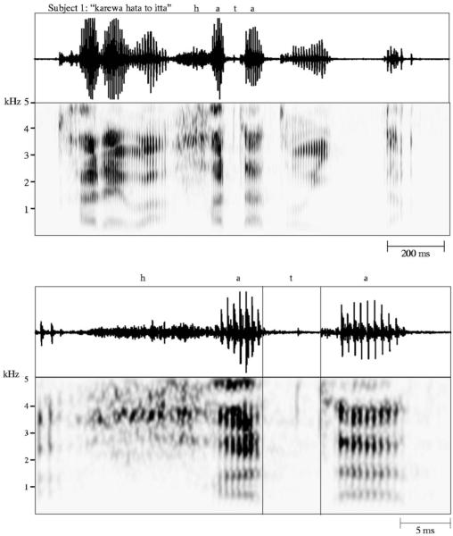 FIG. 1