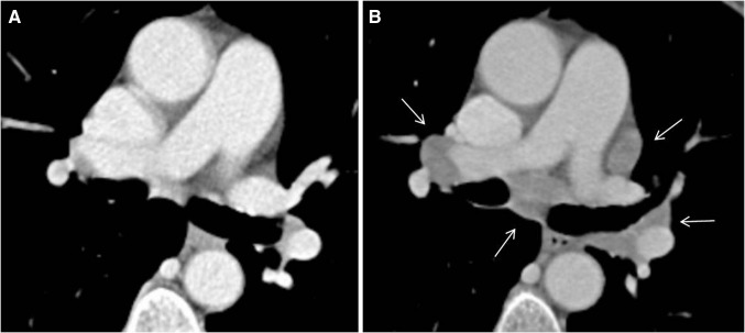 Fig. 7