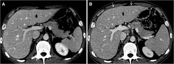 Fig. 2