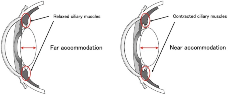 Fig. (1)