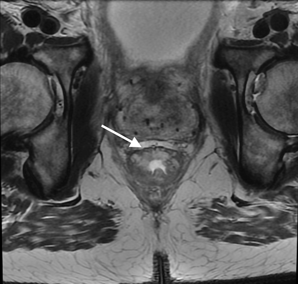 Figure 11.