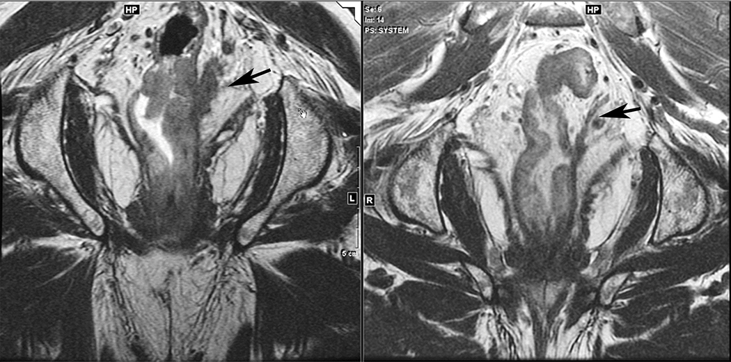 Figure 13.