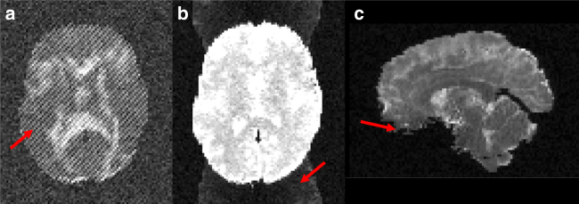 Fig. 9