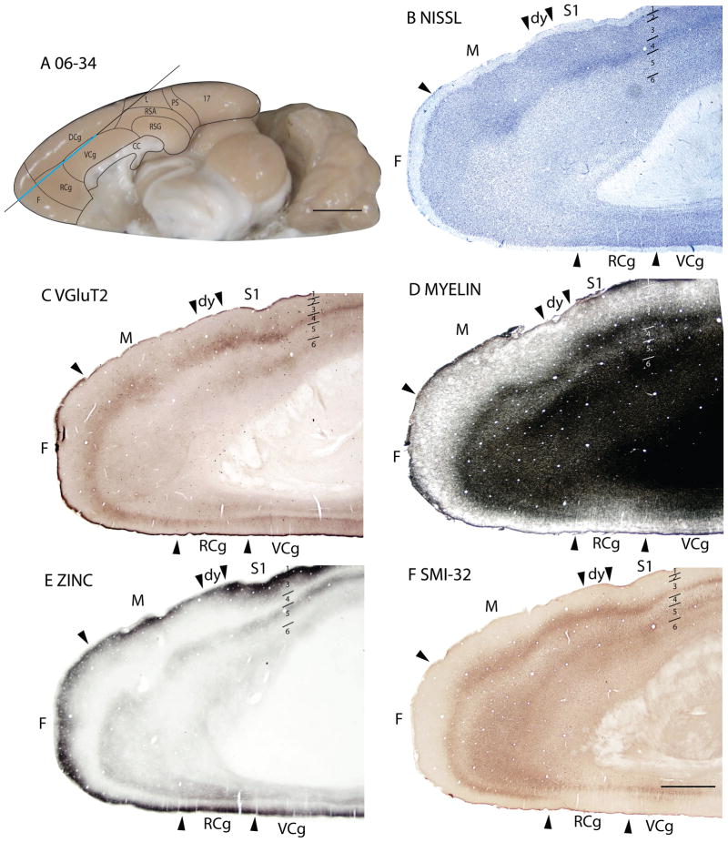 Figure 17