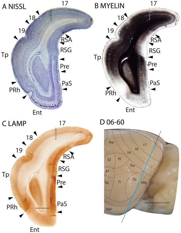 Figure 18